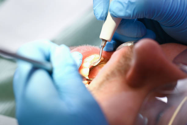 Best Orthodontic Emergency Dentist in Collinsville, CT