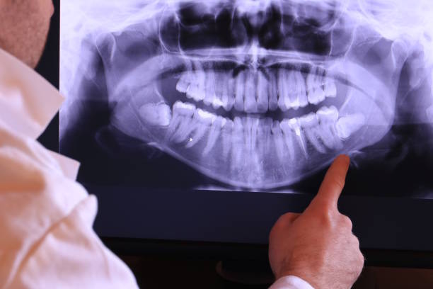 Best Emergency Dentist for Special Needs Patients in Collinsville, CT
