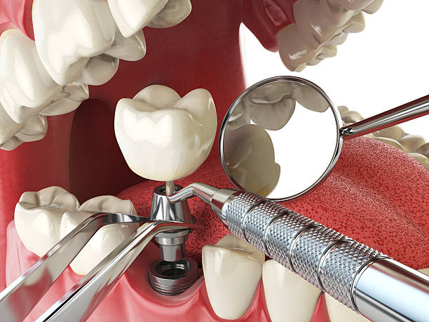 Best Emergency Dental Services for Seniors in Collinsville, CT